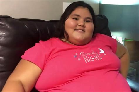 Extreme Weight Loss World S Fattest Teen Sheds Half Her