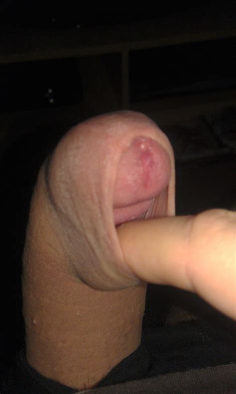 how play with your foreskin mega porn pics