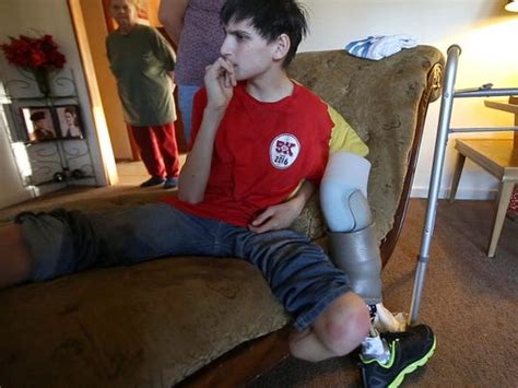 Teen Who Lost Leg In Pit Bull Attack Glad To Be Home