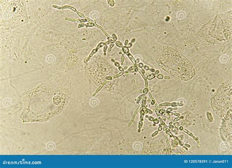 pseudohyphae  budding yeast cells  patient urine stock image image  hyphae analyzing