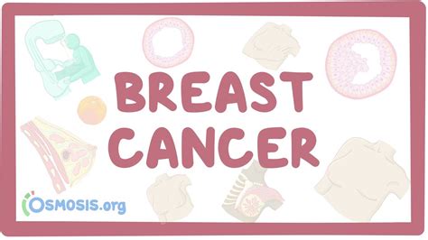 breast cancer video anatomy definition and function osmosis
