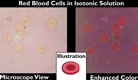 understanding  hemolyzed blood test results hrfnd