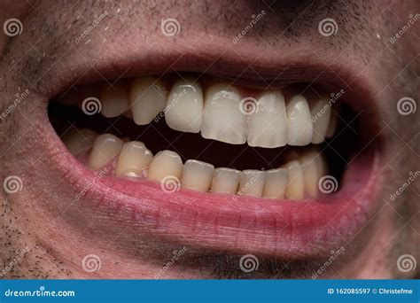 image  young man  open mouth showing teeth stock image image