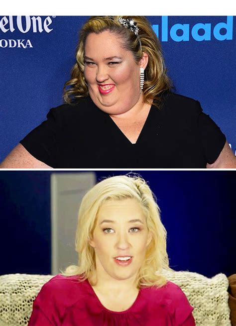 [pics] Mama June’s Smile Makeover — Teeth In Before