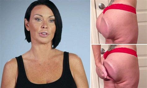 woman who can flip her butt implants due to botched surgery world videos and women s