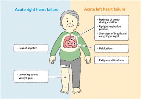 acute  sided heart failure