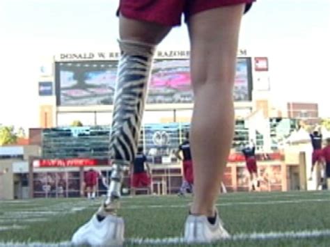 Cheerleader With Prosthetic Leg Inspiring Others Video On