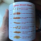 bristol stool chart ceramic mug amazoncouk home kitchen