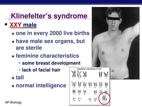 Ppt Errors Of Meiosis Chromosomal Abnormalities Powerpoint