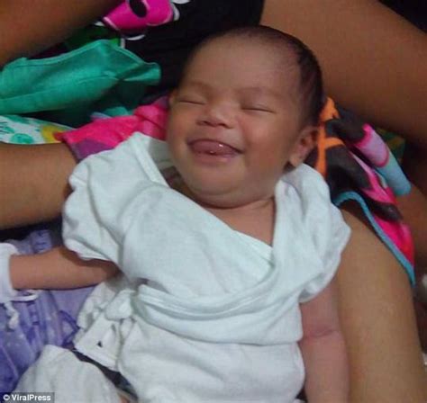 Filipino Girl Is Being Suffocated By Tumour Ridden Tongue Daily Mail