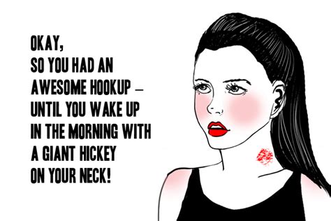 how to get rid of a hickey the ultimate hickey guide
