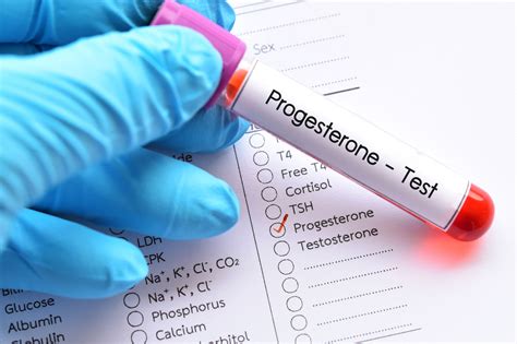 progesterone testing test your progesterone levels