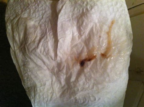 Brown Discharge When Wipe Vagina Xxx Photo