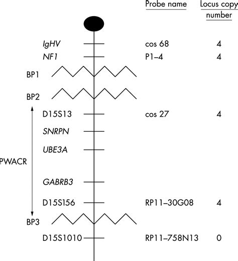 A Supernumerary Marker Chromosome 15 Tetrasomic For The Prader Willi