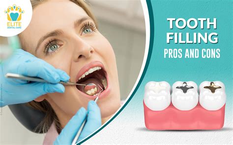 pros  cons  undergoing dental tooth filling elite