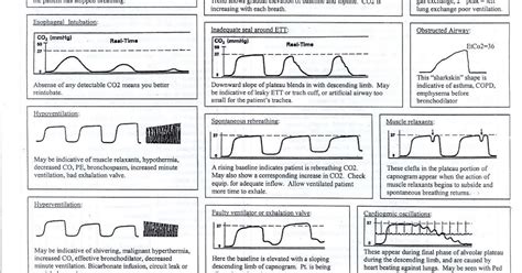 respiratory therapy cave capnography cheat sheet