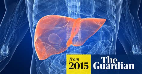 most liver transplants by 2020 will be linked to over eating not
