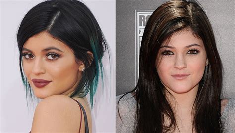 the kardashians before and after plastic surgery