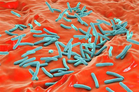 tuberculosis bacteria photograph  kateryna konscience photo library