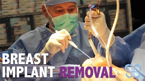 breast implant removal explant surgery brown plastic surgery youtube