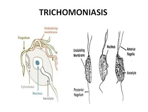 The Trichomoniasis And Mycoplasma Genitalium Syndrome