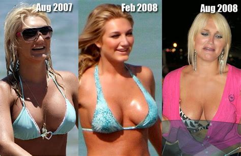 Brooke Hogan Plastic Surgery Breast Implants Nose Job Before And After
