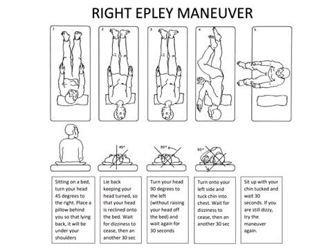 √ Epley S Maneuver Modified Epleys Left It Is Also