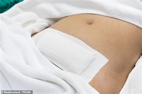 hysterectomy by keyhole that spares a woman s love life daily mail online