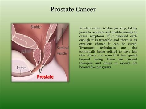 Prostate Cancer Treatment And Management