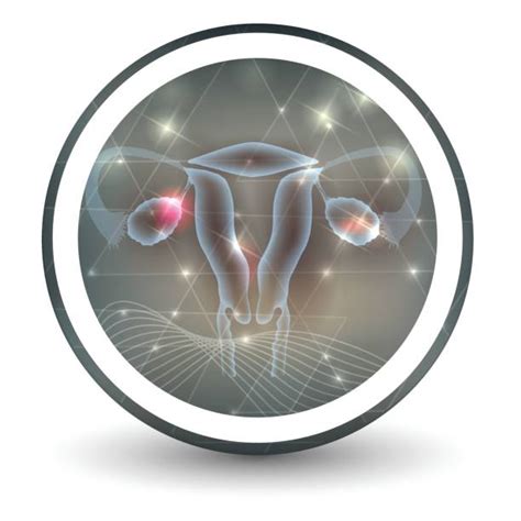 Polycystic Ovary Syndrome Illustrations Royalty Free Vector Graphics