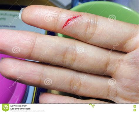 closeup finger transsexual women