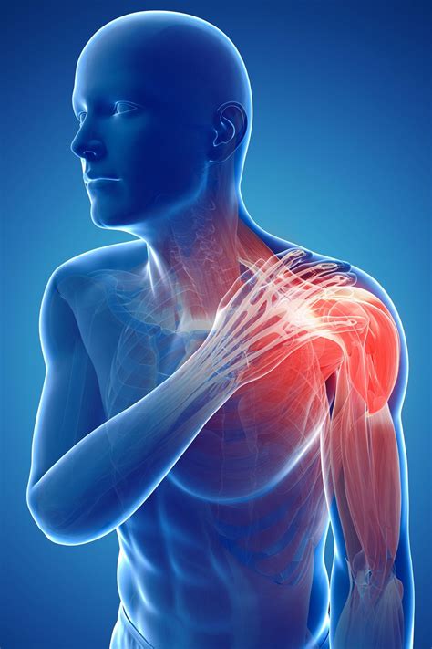 shoulder blade pain fajar magazine