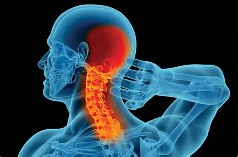 cervical spine neck pain