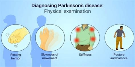 parkinson s disease diagnosis treatment and preventions msrblog