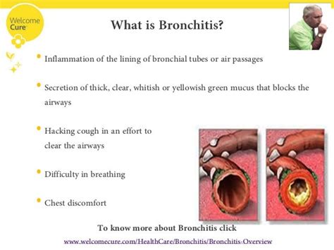 fighting bronchitis the right way a look into its homeopathic treatm…