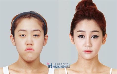 crazy transformations  south koreas controversial plastic surgery reality show