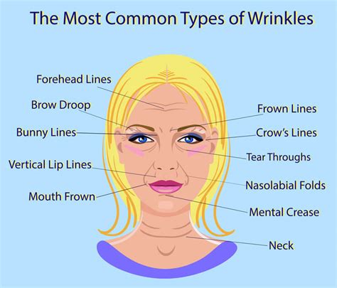 common types  facial wrinkles rhytides westlake dermatology