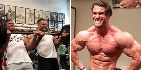 Bodybuilder Calum Von Moger Shows His Body Post Surgery