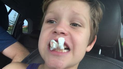 First Dentist Tooth Pulled Youtube