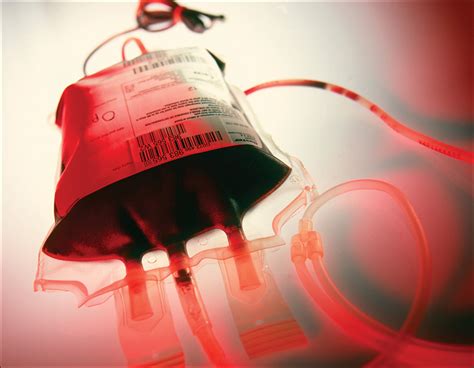 blood transfusion strategies  ecmo   covid  pandemic