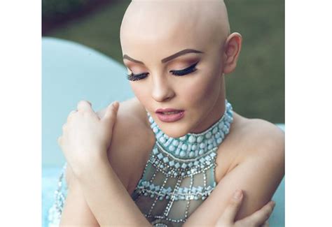 adolescente com câncer vira modelo em ensaio de princesa