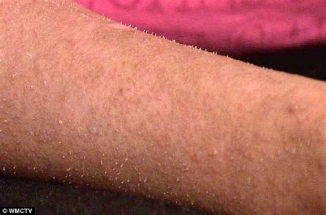 strangest   growing   human skin