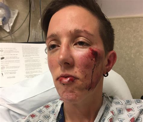 woman beaten unconscious in long island hate crime the
