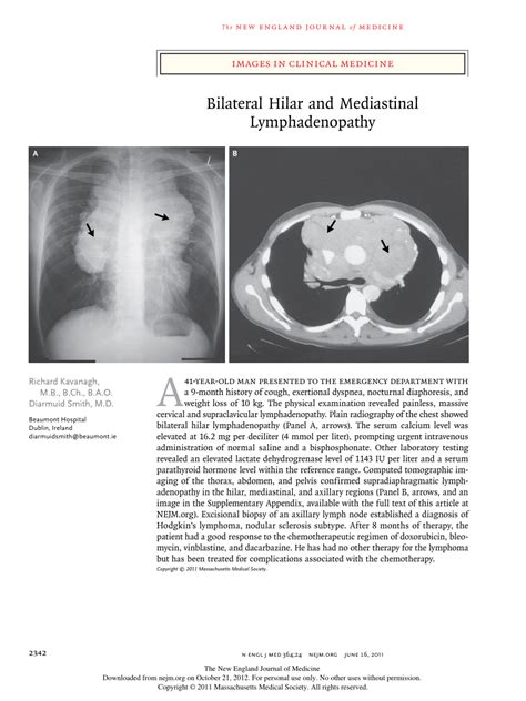Pdf Images In Clinical Medicine Bilateral Hilar And Mediastinal