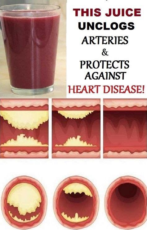 this juice unclogs arteries and protects against heart disease