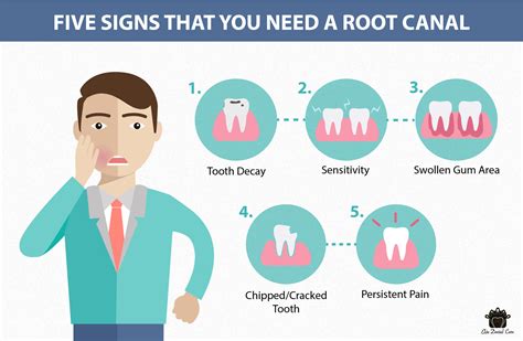 root canal treatment elite dental care tracy elite dental care