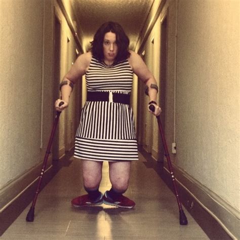 Why I No Longer Apologize For My Crutches Huffpost