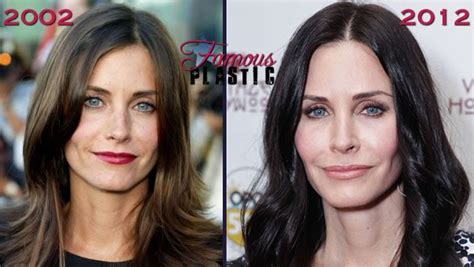 courtney cox before and after bad plastic surgery
