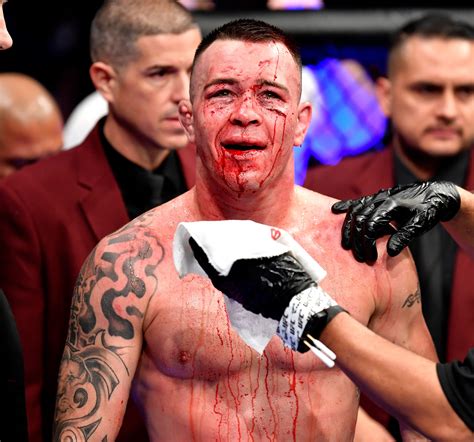 loud mouthed colby covington shows off x ray of brutally broken jaw