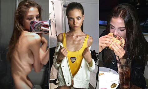 teenage russian model hits back at new eating disorder